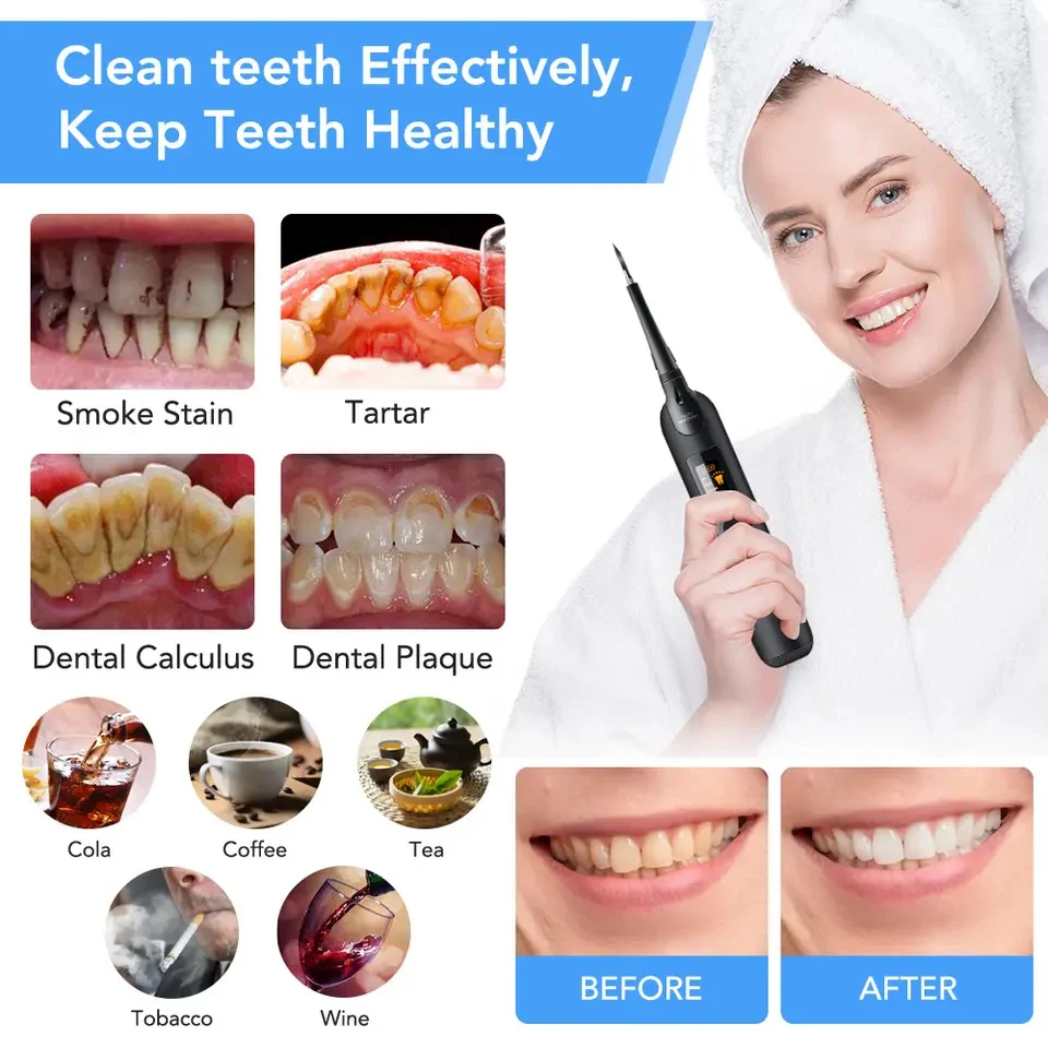 Teeth plaque remover - Image 4